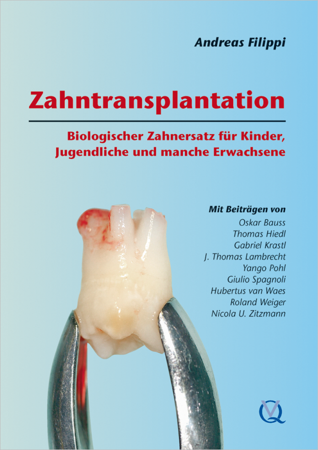 Transplantation von Zähnen
